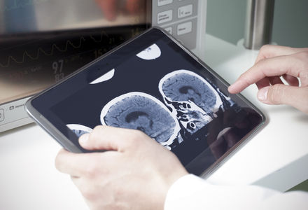 Neuroprogressive and Dementia Network part of global MSA study success as one of four UK sites